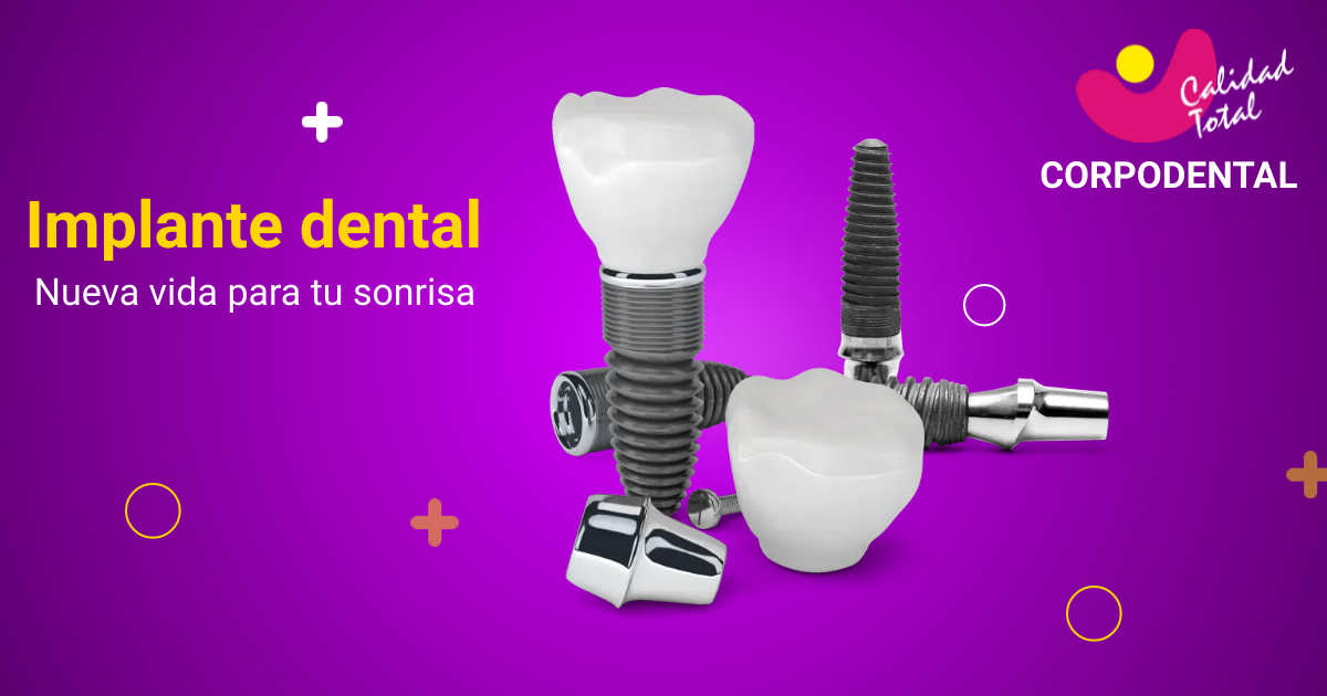 Implante Dental